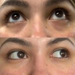 CLINIQUE All About Eyes 15ml