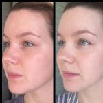 COSRX Galactomyces 95 Tone Balancing Essence 100ml