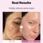 COSRX The Niacinamide 15 Serum 20ml