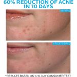 La Roche-Posay Effaclar Duo+M 40ml